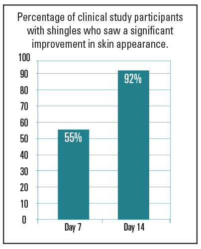 Shingles Chart Shingles Chart